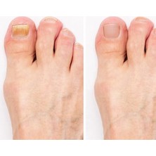 Eco Lounge Yoğun Içerikli Tırnak Bakım Serumu