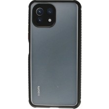 Xiaomi Mi 11 Lite Kılıf Miami Şeffaf Silikon - Siyah