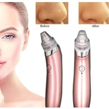 Braventa Collection Profesyonel Vakumlu Siyah Nokta Akne Cilt Temizleme Cihazı