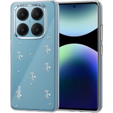 Eco Port Xiaomi Redmi Note 14 Pro 4g Fiyonk Desenli Kapak - Desen 2