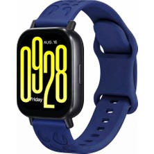 MMP Shop Xiaomi Redmi Watch 5 Active / Lite Uyumlu Leopar Desenli Soft Silikon Kordon
