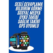 Sepetink Yeni Nesil Akıllı Saat Amoled Ekran Yüksek Çözünürlüklü 41 mm Kasa
