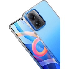 Rory Newface Xiaomi Poco X7 Pro Glossy Kapak - Mavi