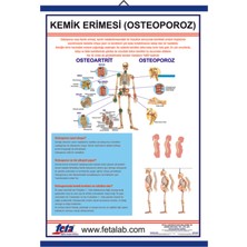 Edulab Osteoporoz Eğitim Plakası (KEMİK ERİMESİ)