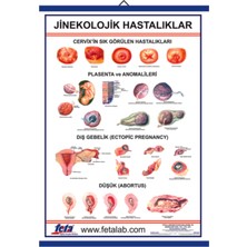 Edulab Jinekolojik Hastalıklar Eğitim Plakası
