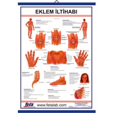 Edulab EKLEM İLTİHABI LEVHASI