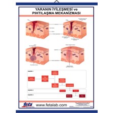 Edulab YARANIN İYİLEŞMESİ EĞİTİM LEVHASI
