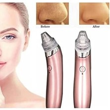 Aesco Profesyonel Vakumlu Siyah Nokta Akne Cilt Temizleme Cihazı