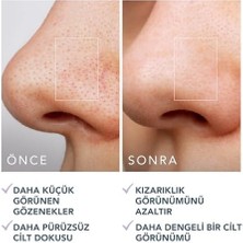 Aesco Gözenek Minimizing Toner Pedleri 60 Adet – Witch Hazel & Centella Asiatica Peeling Yüz Pedleri, Yağ, Akne Taç Cilt Için – Gözenek Minimizer ve Redness Rölyef