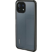 Datatek Newface Xiaomi Mi 11 Lite Kılıf Miami Şeffaf Silikon - Siyah