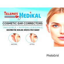 Telepati Medikal Kepçe Kulak Bandı,20 Adet Kozmetik Kulak Düzeltici Bant
