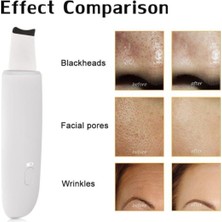 Normadia Siyah Nokta ve Sivilce Temizleme Ultrasonik Cihazı