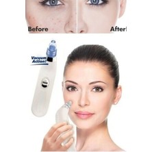 Normadia Suction Siyah Nokta Temizleme Cihazı, Güçlü ve Etkili Cilt Bakımı