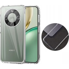 Prolysus Honor Magic8 Lite 5g Kılıf Mat Yumuşak Silikon Kılıf