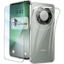 Teleplus Honor Magic 8 Lite Kılıf Kamera Korumalı Tpu Mpl Silikon + Nano Ekran Koruyucu