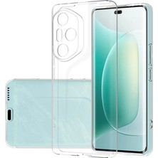 Kvy Honor 300 Pro Kamera Korumalı Süper Silikon Kılıf