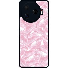 Scaleta Case Camon 30 Pro Uyumlu Kiss Tasarımlı Glossy Mat Siyah Silikon Telefon Kılıfı