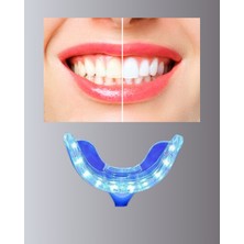 Astraltech Mavi Işık Teknolojisi ile Güvenli Diş Beyazlatıcı Sistem