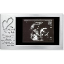 Astera Gümüş Saten 15X10 ve Gri Kalp Bebek Çerçeve Seti