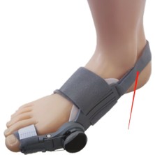 Özgürce Ayarlı Baş Parmak Kemik Düzeltici, Gece Ateli, 1 Adet