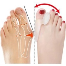 Özgürce 2'li Silikon Jel Makaralı Halluks Valgus Düzeltici Ayak Ateli