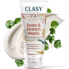 Hype Store Yara Izi ve Çatlak Giderici Krem – Centella Asiatica, Vitamin E ile Cilt Yenileyici – Doğum Sonrası,