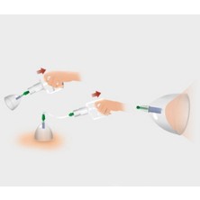 Aesco Vakumlu Göğüs Büyütücü - Lisinya