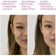 Velora Ufo Mini 2 Power Maske ve Işık Terapi Cihazı