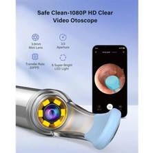 Hızlı Stok Bebird T5 3mp Kamera 3.5mm Lens Şarjlı Wifi Görüntülü Kulak Temizleyici Siyah Renk