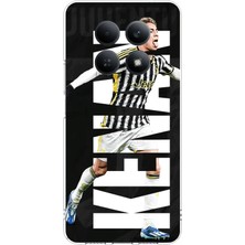 TechTree Redmi Note 15 4g Uyumlu Kenan Yıldız Sevinç Baskılı Silikon Kılıf