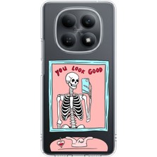 TechTree Redmi Note 15 4g Uyumlu You Look Good Iskelet Tasarımlı Baskılı Silikon Kılıf