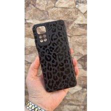 Vip Case Redmi Note 11/11S Uyumlu Leopar Desenli Silikon Darbe Emici Klasik Korumalı Rubber Kılıf