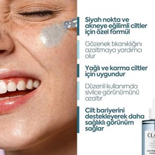Niacinamide Yüz Serumu – Gözenek Görünümünü Sıkılaştırmaya ve Yağ Dengesini Desteklemeye Yardımcı – Siyah Nokta & Leke Görünümü Için Aydınlatıcı Bakım Serumu, 50 ml