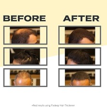 Nesil Saç Dolgunlaştırıcı Pudra 14 Gr. | Seyrek Saçlar Için Saç Fiberi | Fixdeep Suda Çıkmaz (Koyu Kahve)