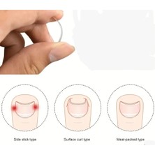 İsmiyle Al Baş Parmak Tırnak Batmasını Engelleyen Metal Aparat Nrd 603 ***