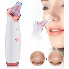 Cekar Store Şarjlı Siyah Nokta Temizleme Cihazı 5 Başlıklı (5324)