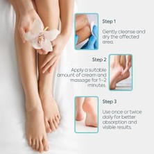 Skygo Clasycare Topuk Çatlağı Kremi – Kuru ve Çatlamış Topuklar Için – E Vitamini ve Avokado Yağlı Topuk Kremi – Nasır, Sert ve Ölü Deriler Için Nemlendirici Ayak Bakım Kremi – 100 ml