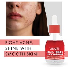 Vıtayes Aha%10 Bha%2 Kırmızı Peeling Cilt Serumu - Gözenek Sıkılaştırıcı, Cilt Canlandırıcı, Yenileyici, Ton Eşitleyici, Arındırıcı, Siyah Nokta ve Akne Karşıtı, Anti-Aging, Yaşlanma Karşıtı 30 ml