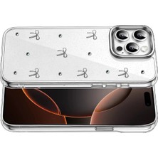 No35 Newface Apple Iphone 15 Pro Fiyonk Desenli Kapak - Desen 5