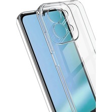 No35 Newface Xiaomi Redmi 15C 4g Lüx Şeffaf Silikon - Şeffaf