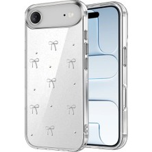 xirshop Apple Iphone 17 Air Fiyonk Desenli Kapak - Desen 5