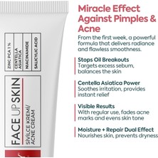 Akne Kremi Yüz Için – Sivilce ve Akne Karşıtı Leke Kremi – Salisilik Asit & Niasinamid ile Leke Gide