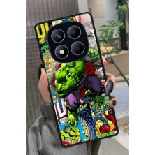 Snacase  Xiaomi Redmi Note 14 Pro 4g Uyumlu Hulk Tasarımlı Parlak Silikon Kılıf