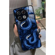 Snacase Tecno Spark 30 Uyumlu Araba Logosu Tasarımlı Parlak Silikon Kılıf