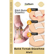 Carlburn Özel Üretim Ayak Tırnağı Ağrısı Giderici Düzeltici Evde Güvenli Kolay Bakım Batık Tırnak