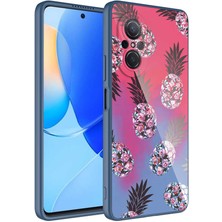 Huawei Nova 9 Se Kılıf Kamera Korumalı Desenli Sert Silikon Nrtk Epoksi Kapak-No3