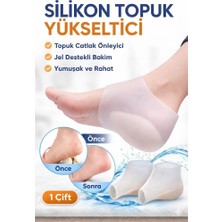 Eser Ticarett Silikon Topuk Koruyucu Çorap 1 Çift – Topuk Çatlak Önleyici Jel Destekli Nemlendirici Koruyucu Beyaz