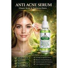 Salisilik Asit & Niacinamide Serumu Akne Karşıtı Sebum ve Gözenek Dengeleyici Etkili Formül