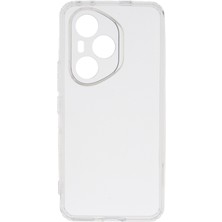 Ceponya Honor 400 Pro Kılıf Köşeleri Airbagli Kamera Çıkıntılı Silikon