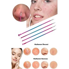 Gökkuşağı Komedon Çift Halka Uçlu Siyah Nokta Temizleme   IĞNESIXLD508D